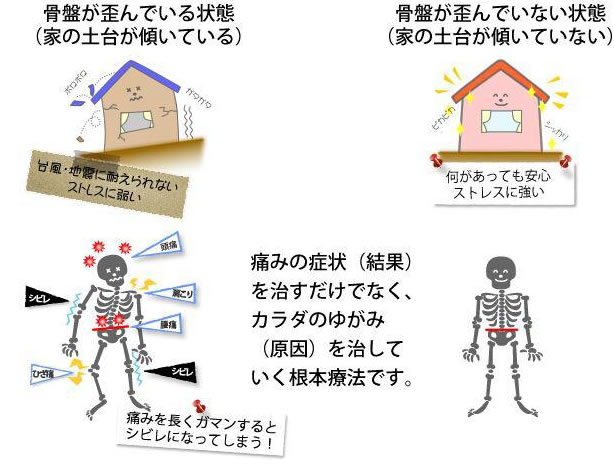 骨盤・背骨と病気の話